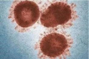 關于新冠肺炎的一切